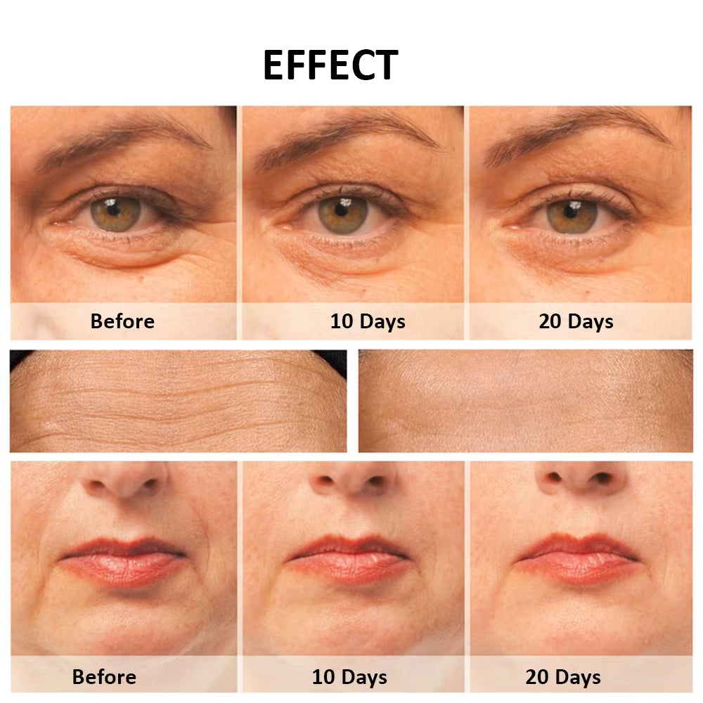 Facial Massager RF Facial Radiofrequency High Frequency Face Lifting Machine EMS Facial Microcurrent Lift Skin Tightening Device