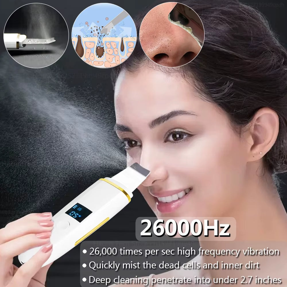 Ultrasonic Skin Scrubber Remover Blackhead Ultrasonic Peeling Facial Scrubber Shovel Face Lifting Remove Pore Acne Deep Cleaning